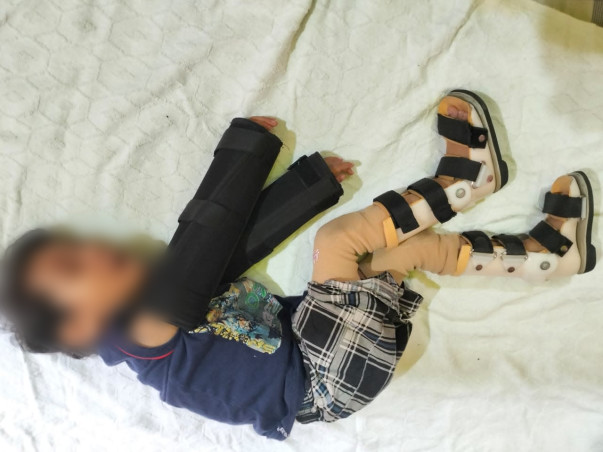 3 Years Old Md Hasan Usmani Needs Your Help To Recover From Cerebral Palsy