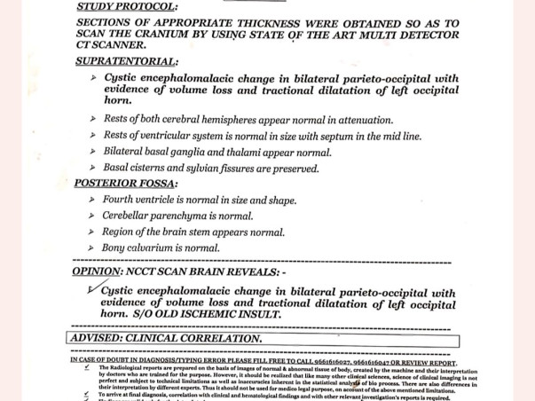 3 Years Old Md Hasan Usmani Needs Your Help To Recover From Cerebral Palsy