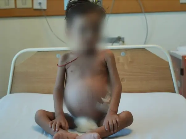 2-Year-Old Has Few Days To Live Without An Urgent Liver Transplant