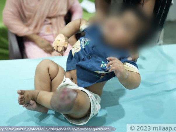 help-daughter-of-parul-recover