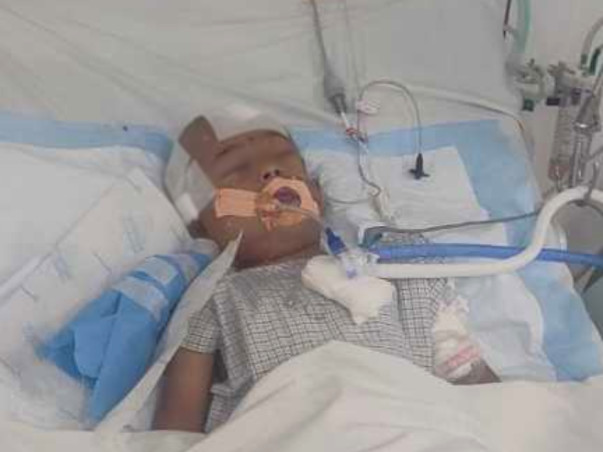 Help My Son To Recover From Accidental Head Injury