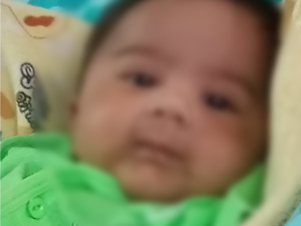 4 months old Shaik Mohammad Zayaan needs your help fight Spinal Muscular Atrophy, Type I / SMA1