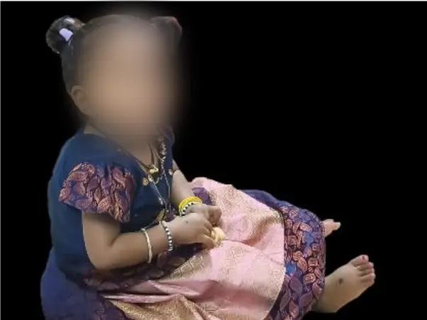 Help Baby of Ajith Kumar fight Spinal Muscular Atrophy, Type II / SMA2