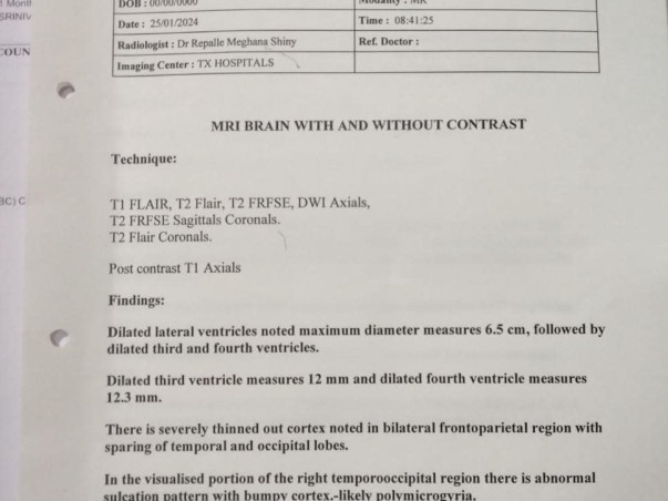 Support Chutki to survive from Brain fluid issue