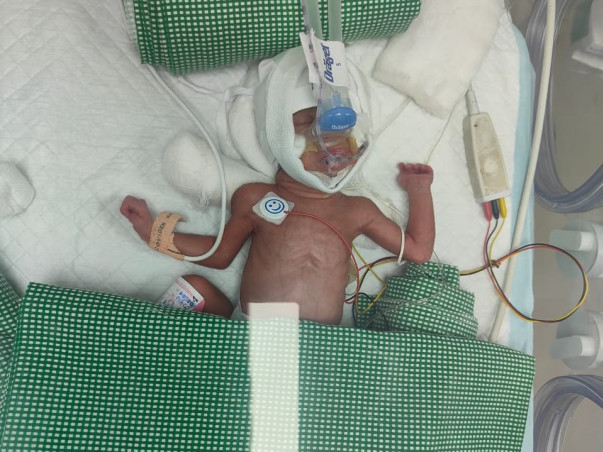 Help my daughter fight Preterm Birth/Preterm Complications