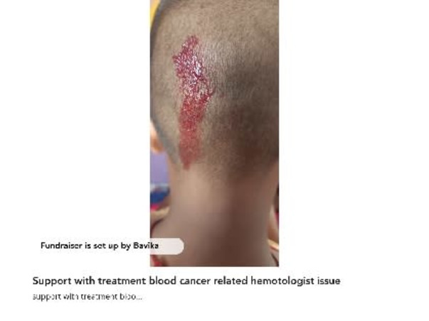 Support with treatment blood cancer related hemotologist issue
