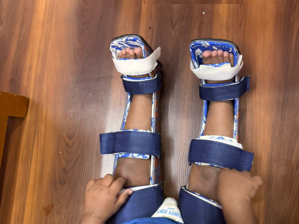 Help Baby Sai Chirag Fight Spinal Muscular Atrophy (SMA Type 2)