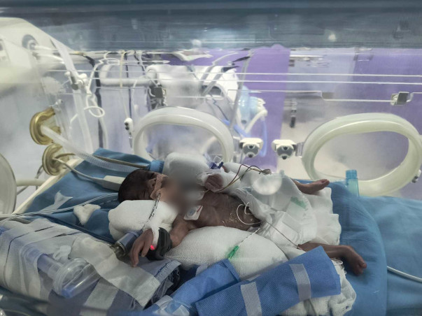 Help Save Premature Twin Baby Girls of Sneha & Dheeraj