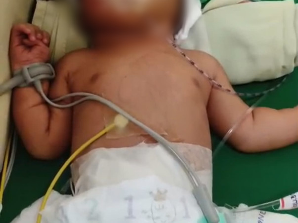 Urgent Help 🙏 My sister’s newborn baby is on ventilator in NICU