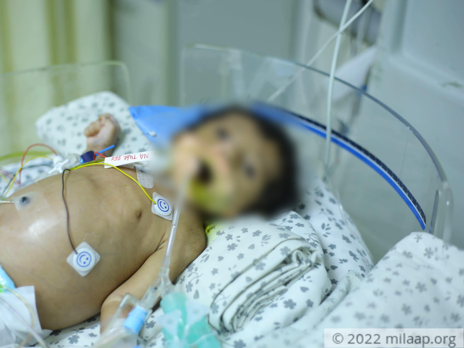 Yp1a0573 yra2qw 1650996990 ifcx8v 1651227123