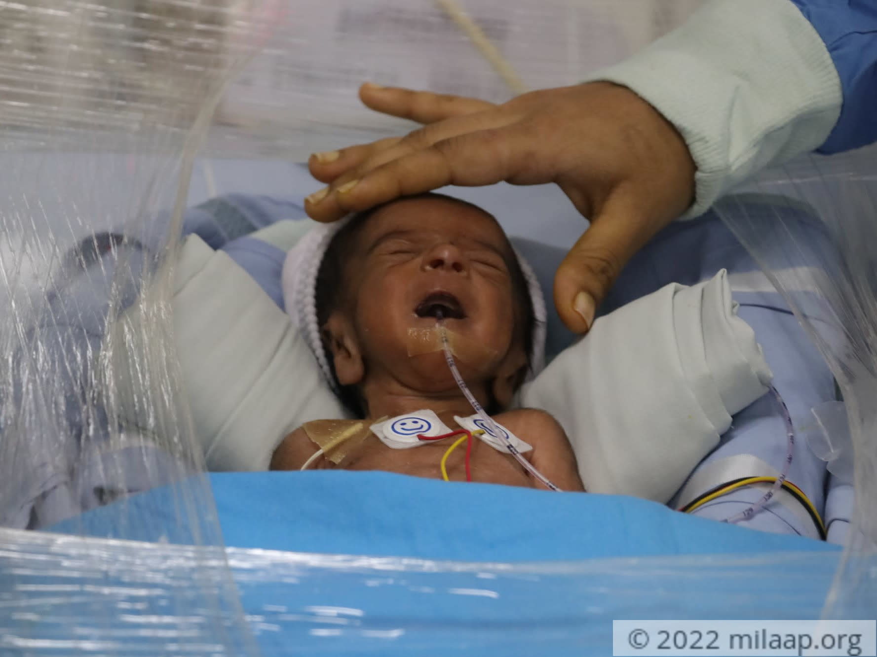 Img 0699 jomzrp 1647778932 vhhrj9 1648028731